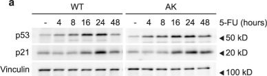 Fig.3.A showing Western Blotting from the publication: Rewiring glucose metabolism improves 5-FU efficacy in p53-deficient/KRASG12D glycolytic colorectal tumors.