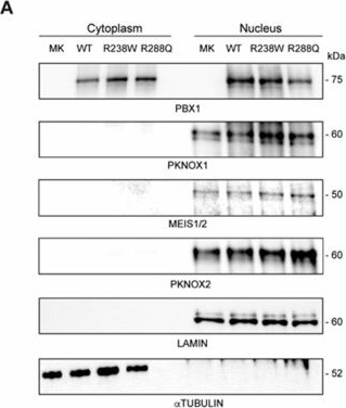 Fig.4.A showing Western Blotting in a Homo sapiens (Human) sample from the publication: Functional Characterization of a Novel PBX1 De Novo Missense Variant Identified in a Pediatric Patient with CAKUT.