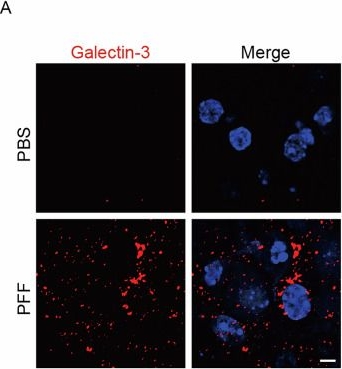 Fig.1.A showing Immunocytochemistry-immunofluorescence in a Mus musculus (House mouse) sample from the publication: Lysine acetyltransferase 8-mediated histone acetylation, regulated by GBA1, is associated with lysosomal function related to α-Synuclein pathology.