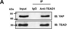 Fig.4.A showing Western Blotting from the publication: YAP-mediated glycolysis promotes pulmonary arterial smooth muscle cell proliferation in pulmonary arterial hypertension.