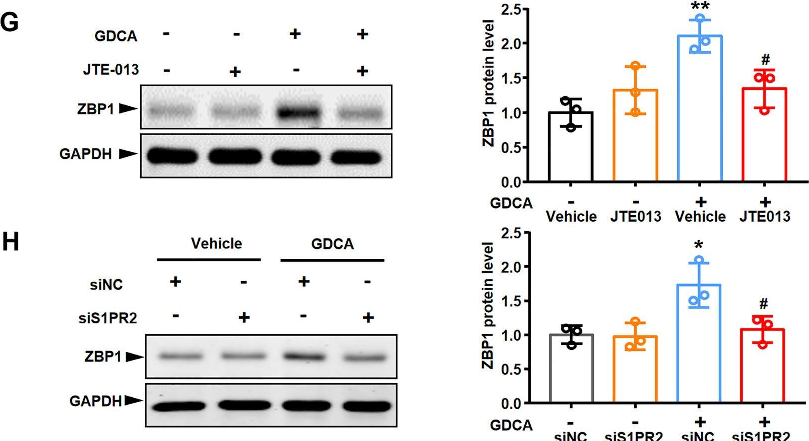 Fig.7.G showing Western Blotting from the publication: Necroptosis of macrophage is a key pathological feature in biliary atresia via GDCA/S1PR2/ZBP1/p-MLKL axis.