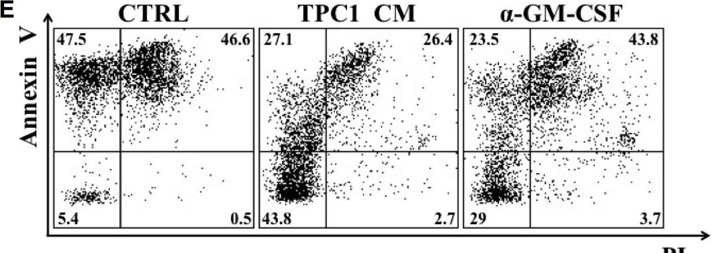 Fig.2.E showing Flow cytometry/Cell sorting from the publication: Potential involvement of neutrophils in human thyroid cancer.