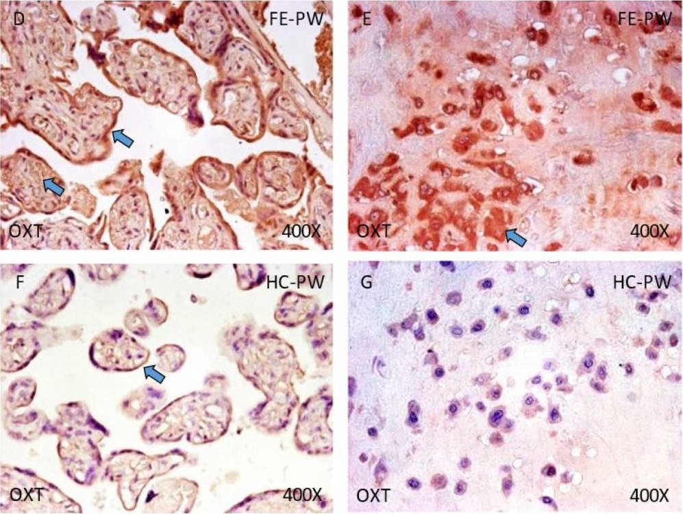 Fig.1.D showing Immunohistochemistry in a Homo sapiens (Human) sample from the publication: Assessment of Tissue Expression of the Oxytocin-Vasopressin Pathway in the Placenta of Women with a First-Episode Psychosis during Pregnancy.