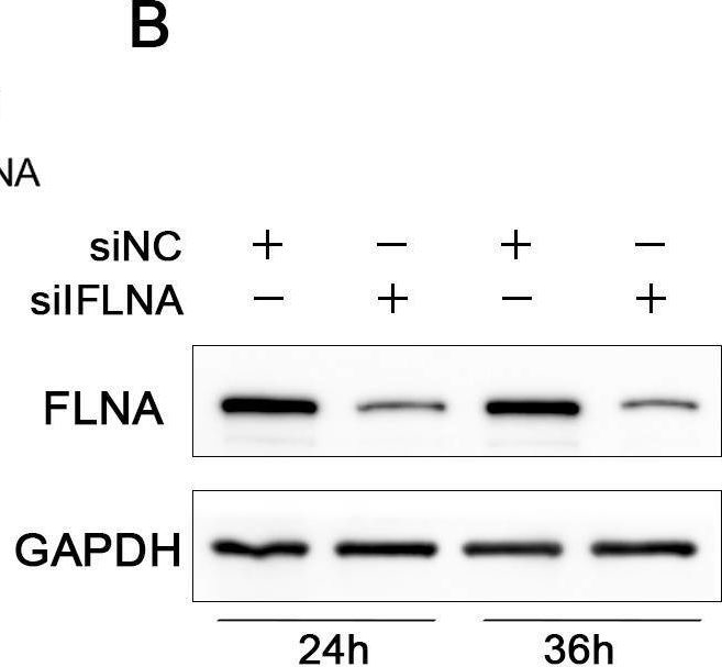 Fig.5.B showing Western Blotting in a Klebsiella pneumoniae sample from the publication: PRRSV promotes bacterial infection by remodeling actin cytoskeleton and cell membrane proteins.