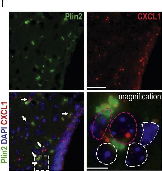 Obesity-Induced Cellular Senescence Drives Anxiety and Impairs Neurogenesis.