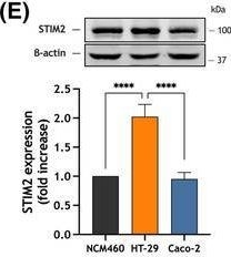 Fig.1.E showing Western Blotting from the publication: Postbiotics of Lacticaseibacillus paracasei CECT 9610 and Lactiplantibacillus plantarum CECT 9608 attenuates store-operated calcium entry and FAK phosphorylation in colorectal cancer cells.