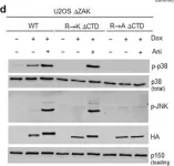 Fig.1.D showing Western Blotting in a Homo sapiens (Human) sample from the publication: Computational and Functional Analysis of Structural Features in the ZAKα Kinase.