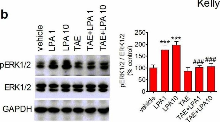 Fig.3.B showing Western Blotting from the publication: Lysophosphatidic Acid Stimulates Mitogenic Activity and Signaling in Human Neuroblastoma Cells through a Crosstalk with Anaplastic Lymphoma Kinase.