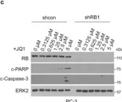 Fig.1.C showing Western Blotting from the publication: Retinoblastoma protein as an intrinsic BRD4 inhibitor modulates small molecule BET inhibitor sensitivity in cancer.