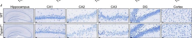 Fig.4.J showing Immunohistochemistry in a Rattus norvegicus (Rat) sample from the publication: Integrin β1/FAK/SRC signal pathway is involved in autism spectrum disorder in Tspan7 knockout rats.