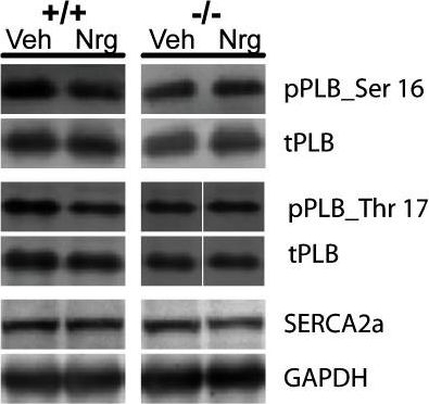 Fig.5.G showing Western Blotting in a Mus musculus (House mouse) sample from the publication: The effects of neuregulin on cardiac Myosin light chain kinase gene-ablated hearts.