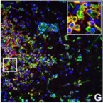 Fig.7.G showing Immunohistochemistry-immunofluorescence in a Mus musculus (House mouse) sample from the publication: IFN-gamma signaling in the central nervous system controls the course of experimental autoimmune encephalomyelitis independently of the localization and composition of inflammatory foci.
