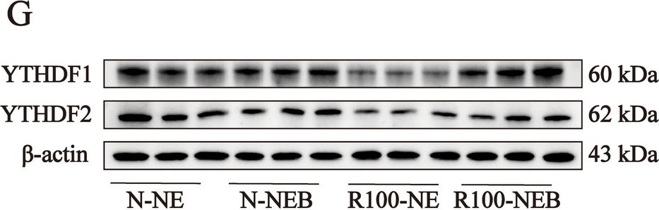 Fig.5.G showing Western Blotting from the publication: Betaine alleviates hepatic lipid metabolism disorder in finishing pigs fed a low-energy diet through regulating m6A RNA methylation.