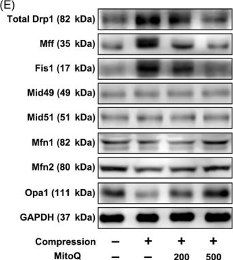 Fig.3.E showing Western Blotting in a Homo sapiens (Human) sample from the publication: The mitochondria-targeted anti-oxidant MitoQ protects against intervertebral disc degeneration by ameliorating mitochondrial dysfunction and redox imbalance.