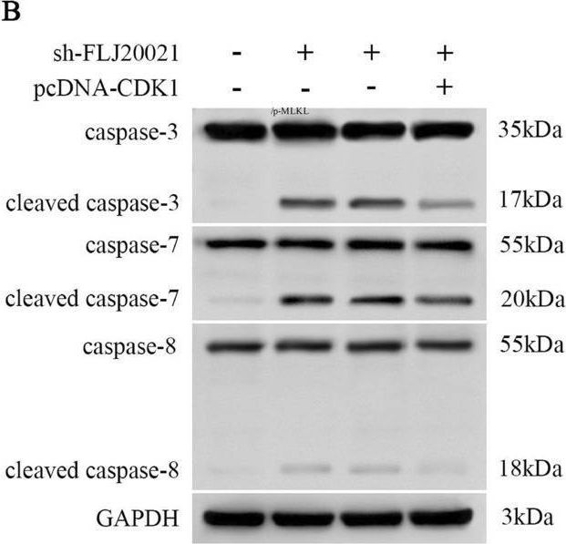 Fig.3.B showing Western Blotting in a Homo sapiens (Human) sample from the publication: lncRNA FLJ20021 regulates CDK1-mediated PANoptosis in a ZBP1-dependent manner to increase the sensitivity of laryngeal cancer-resistant cells to cisplatin.