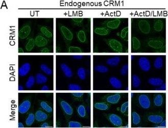 Fig.2.A showing Immunocytochemistry-immunofluorescence in a Homo sapiens (Human) sample from the publication: Mutations of Key Functional Residues in CRM1/XPO1 Differently Alter Its Intranuclear Localization and the Nuclear Export of Endogenous Cargos.