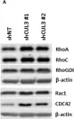 Fig.6.A showing Western Blotting in a Homo sapiens (Human) sample from the publication: Functional Genomic Screening Independently Identifies CUL3 as a Mediator of Vemurafenib Resistance via Src-Rac1 Signaling Axis.
