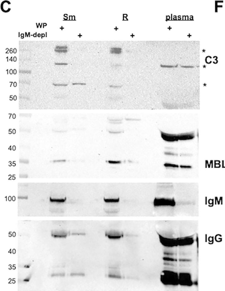 Fig.6.C showing Western Blotting from the publication: Divergent host humoral innate immune response to the smooth-to-rough adaptation of Mycobacterium abscessus in chronic infection.
