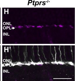 Fig.7.H showing Immunohistochemistry-immunofluorescence from the publication: ERG responses to high-frequency flickers require FAT3 signaling in mouse retinal bipolar cells.