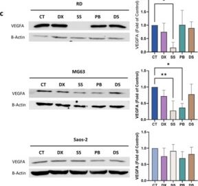 Fig.3.C showing Western Blotting in a Homo sapiens (Human) sample from the publication: Antitumor Activity of Sodium Selenite, Palbociclib, and Disulfiram Against Osteosarcoma and Rhabdomyosarcoma Cell Lines.