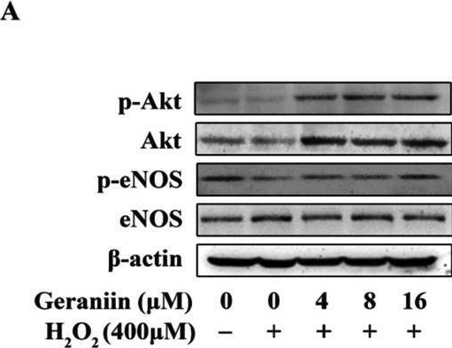 Fig.6.A showing Western Blotting in a Homo sapiens (Human) sample from the publication: Geraniin Alleviates High-Fat Diet-Induced Atherosclerosis in ApoE -/- Mice.