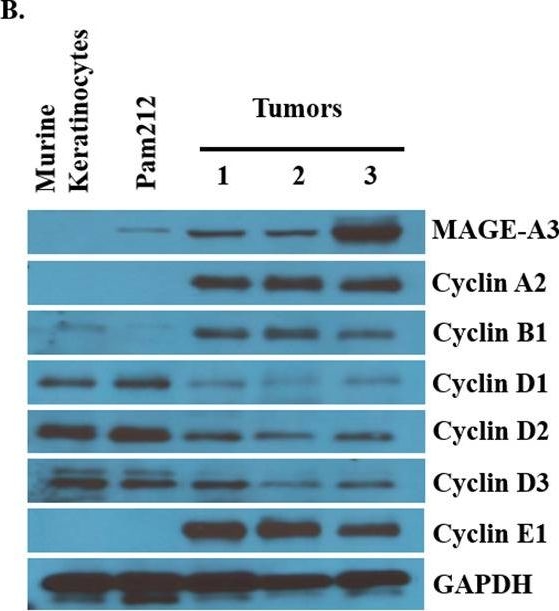 Fig.4.B showing Western Blotting in a Mus musculus (House mouse) sample from the publication: MAGE-A3 is a prognostic biomarker for poor clinical outcome in cutaneous squamous cell carcinoma with perineural invasion via modulation of cell proliferation.