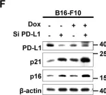 Fig.2.F showing Western Blotting from the publication: STING mediates nuclear PD-L1 targeting-induced senescence in cancer cells.