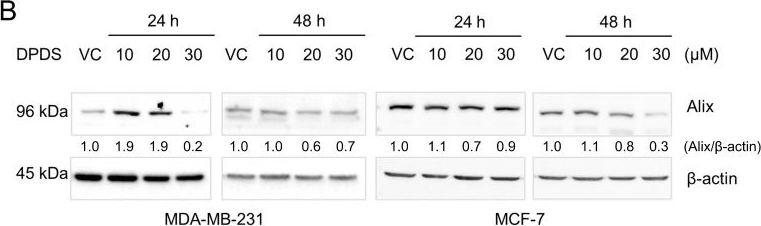 Fig.2.B showing Western Blotting from the publication: Diphenyl Disulfide Induces Nonapoptotic Paraptosis in Breast Cancer Cells via ROS-Mediated ER Stress.