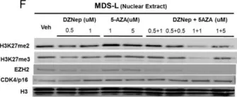 Fig.5.F showing Western Blotting in a Homo sapiens (Human) sample from the publication: The KDM2B- let-7b -EZH2 axis in myelodysplastic syndromes as a target for combined epigenetic therapy.