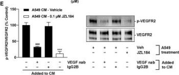 タヒボNFD POPX2 phosphatase regulates apoptosis through the TAK1-IKK