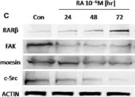 Fig.3.C showing Western Blotting in a Homo sapiens (Human) sample from the publication: Retinoic acid reduces migration of human breast cancer cells: role of retinoic acid receptor beta.