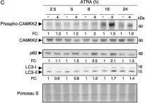 Fig.3.C showing Western Blotting in a Homo sapiens (Human) sample from the publication: Targeting CAMKK2 and SOC Channels as a Novel Therapeutic Approach for Sensitizing Acute Promyelocytic Leukemia Cells to All-Trans Retinoic Acid.