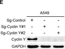 Fig.2.E showing Western Blotting in a Homo sapiens (Human) sample from the publication: Cyclin Y interacts with Chk1 to activate RRM2/STAT3 signaling and promotes radioresistance in non-small cell lung cancer.