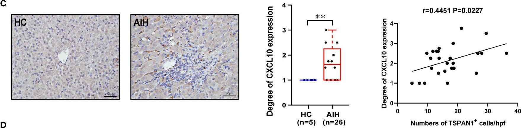 Fig.6.C showing Immunohistochemistry from the publication: The immunological characteristics of TSPAN1 expressing B cells in autoimmune hepatitis.
