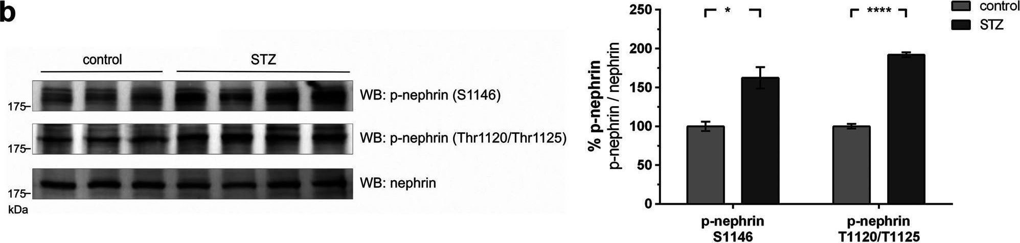 Inhibition of p38 MAPK decreases hyperglycemia-induced nephrin endocytosis and attenuates albuminuria.