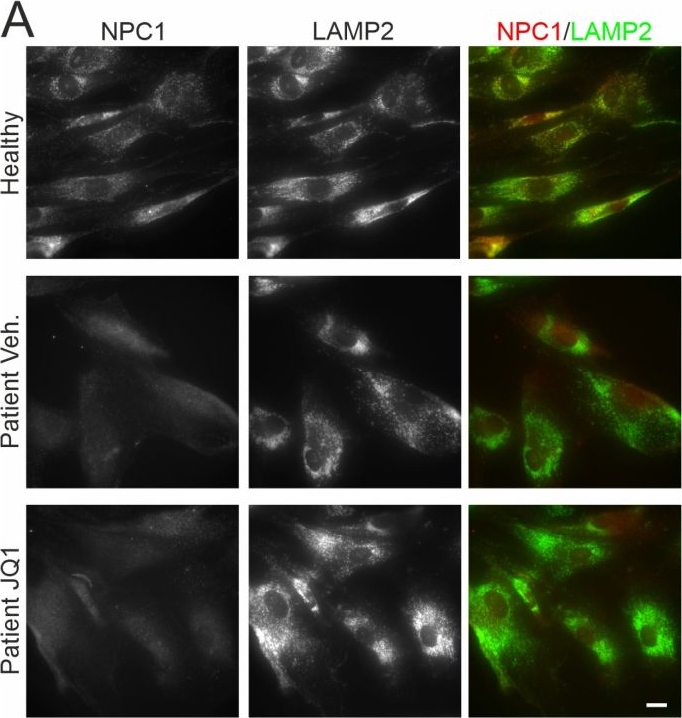 Fig.3.A showing Immunocytochemistry-immunofluorescence in a Homo sapiens (Human) sample from the publication: Exploration of Bromodomain Proteins as Drug Targets for Niemann-Pick Type C Disease.