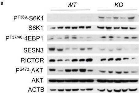 Fig.5.A showing Western Blotting from the publication: FOXO protects against age-progressive axonal degeneration.