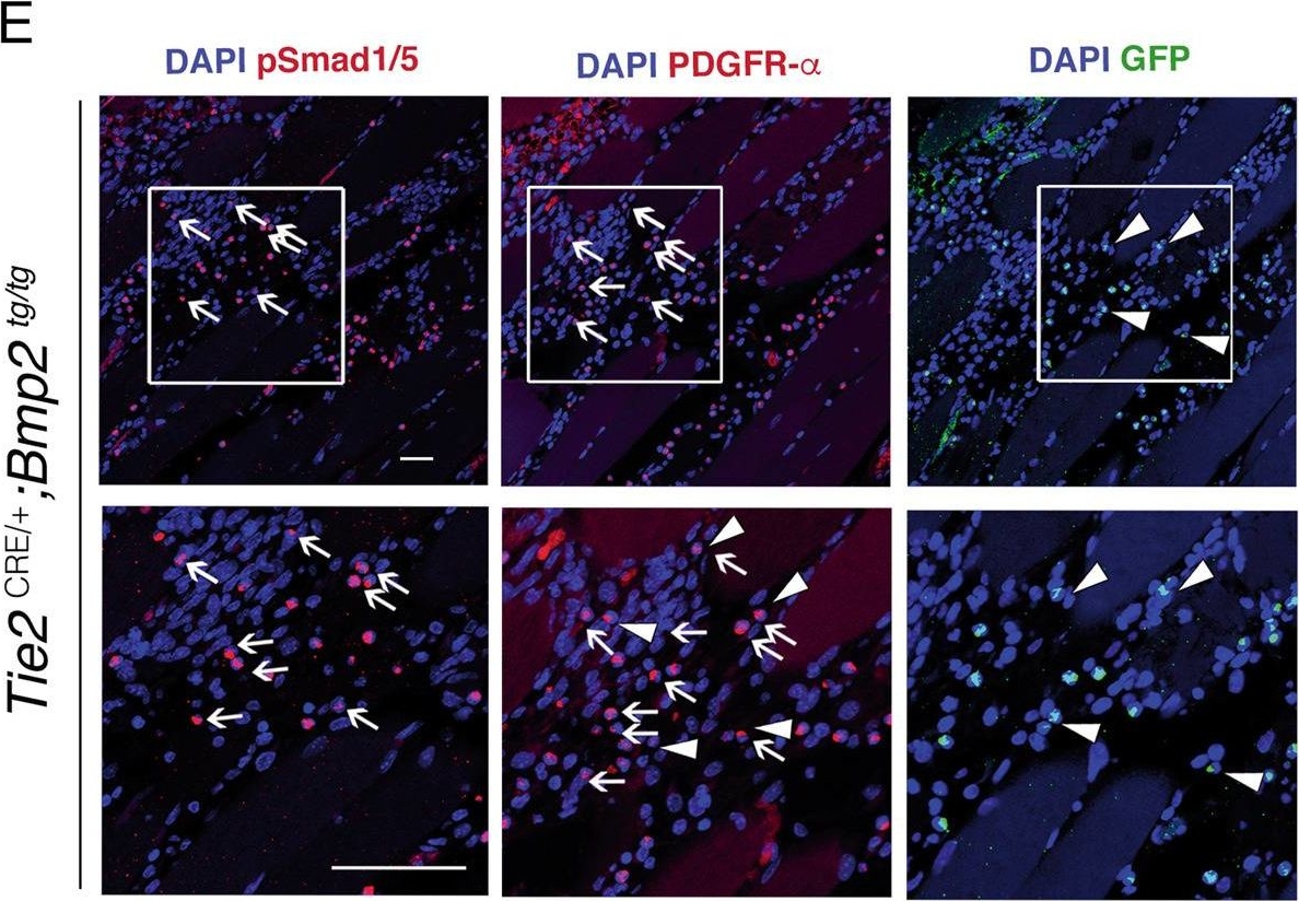 Fig.5.E showing Immunohistochemistry in a Mus musculus (House mouse) sample from the publication: Heterotopic ossification in mice overexpressing Bmp2 in Tie2+ lineages.