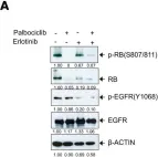 Fig.5.A showing Western Blotting from the publication: The CRTC1-MAML2 fusion is the major oncogenic driver in mucoepidermoid carcinoma.