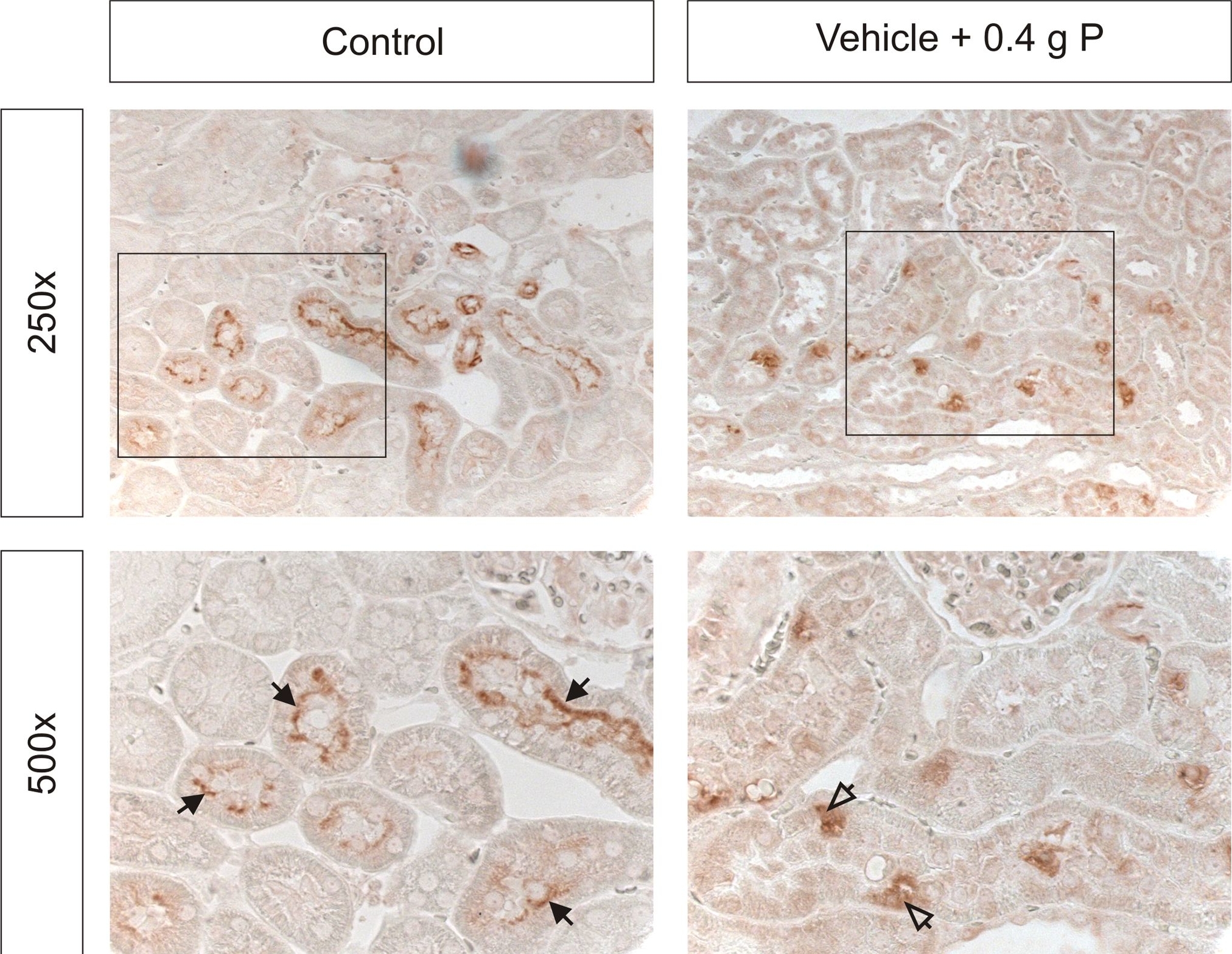 Fig.5.A showing Immunohistochemistry in a Rattus norvegicus (Rat) sample from the publication: Evaluation of intestinal phosphate binding to improve the safety profile of oral sodium phosphate bowel cleansing.