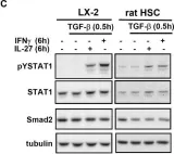 Fig.5.C showing Western Blotting in a Rattus norvegicus (Rat) sample from the publication: Interleukin-27 acts on hepatic stellate cells and induces signal transducer and activator of transcription 1-dependent responses.