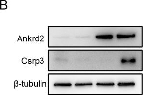 Fig.4.B showing Western Blotting in a Mus musculus (House mouse) sample from the publication: Ankrd2 may alleviate denervation-induced skeletal muscle atrophy by inhibiting inflammation.