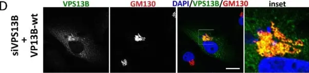 Fig.2.D showing Immunocytochemistry-immunofluorescence in a Homo sapiens (Human) sample from the publication: Disease relevance of rare VPS13B missense variants for neurodevelopmental Cohen syndrome.