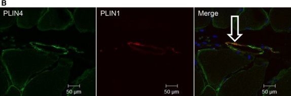 Perilipin 4 in human skeletal muscle: localization and effect of physical activity.