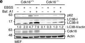 AMPK-dependent activation of the Cyclin Y/CDK16 complex controls autophagy.