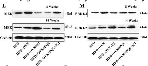 Fig.5.L showing Western Blotting in a Mus musculus (House mouse) sample from the publication: Panax quinquefolium saponin decreases atherosclerosis in ovariectomized ApoE-/- mice via regulating estrogen receptor α.