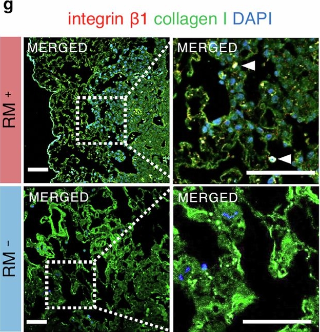 Fig.4.G showing Immunohistochemistry-immunofluorescence from the publication: Lung adenocarcinoma cells respond differently to mechanical stress in 3D versus 2D environments.