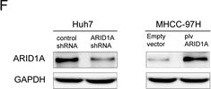 Fig.1.F showing Western Blotting in a Homo sapiens (Human) sample from the publication: Decreased expression of ARID1A associates with poor prognosis and promotes metastases of hepatocellular carcinoma.