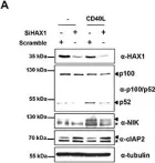 Fig.6.A showing Western Blotting in a Homo sapiens (Human) sample from the publication: HAX1 regulates E3 ubiquitin ligase activity of cIAPs by promoting their dimerization.