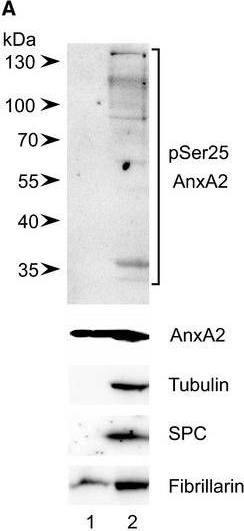 Fig.2.A showing Western Blotting in a Rattus norvegicus (Rat) sample from the publication: Post-translational modifications of Annexin A2 are linked to its association with perinuclear nonpolysomal mRNP complexes.